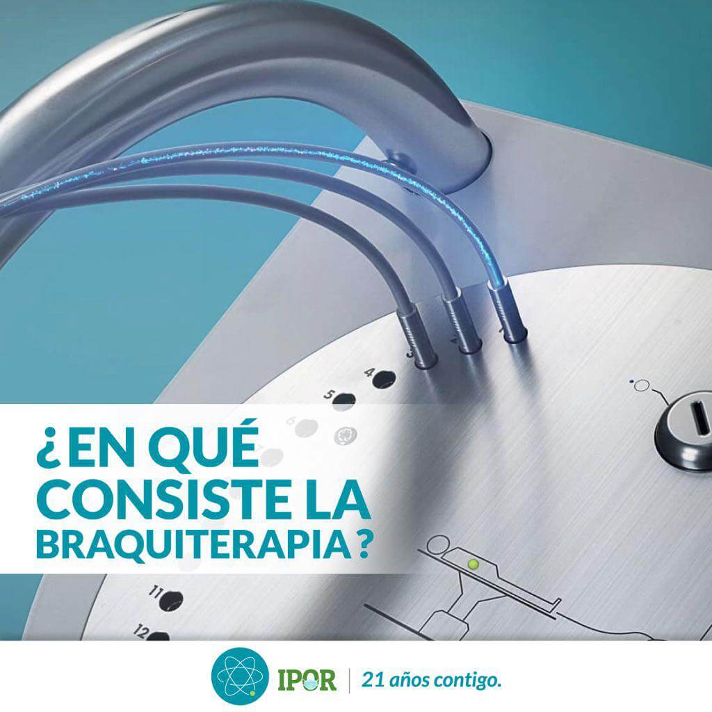braquiterapia