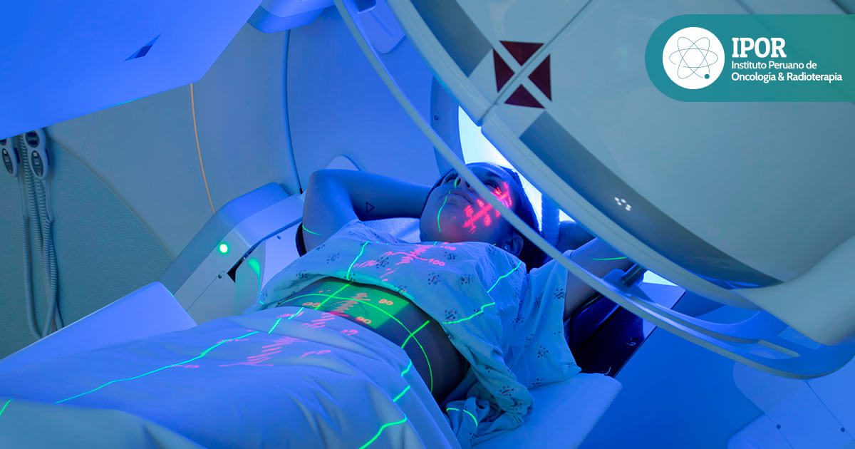 destacada-como-es-el-tratamiento-de-intensidad-modulada